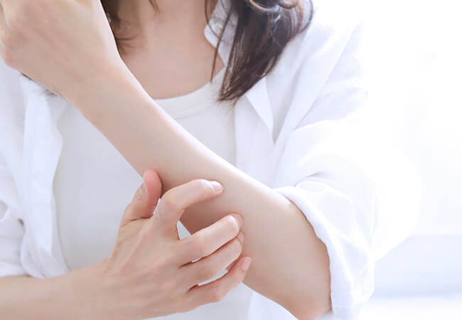 皮膚のかゆみを気にする女性